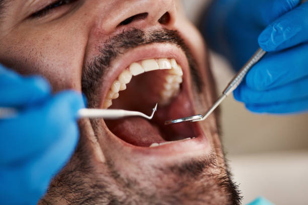 Best Same-Day Emergency Dental Services in Dandridge, TN