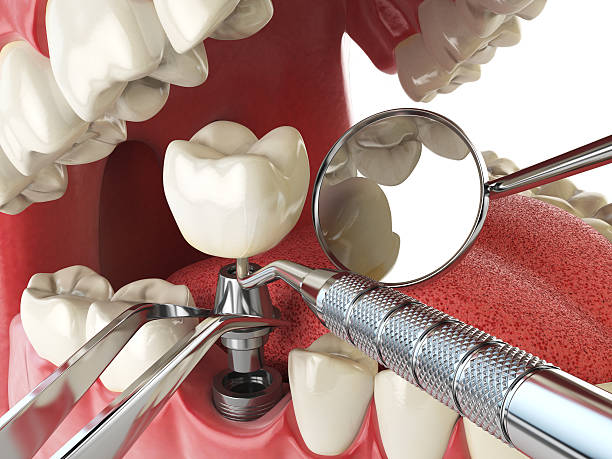 Best Emergency Treatment for Dental Infections or Abscesses in Dandridge, TN