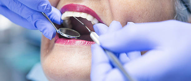 Best Emergency Dental Care for Broken or Chipped Teeth in Dandridge, TN